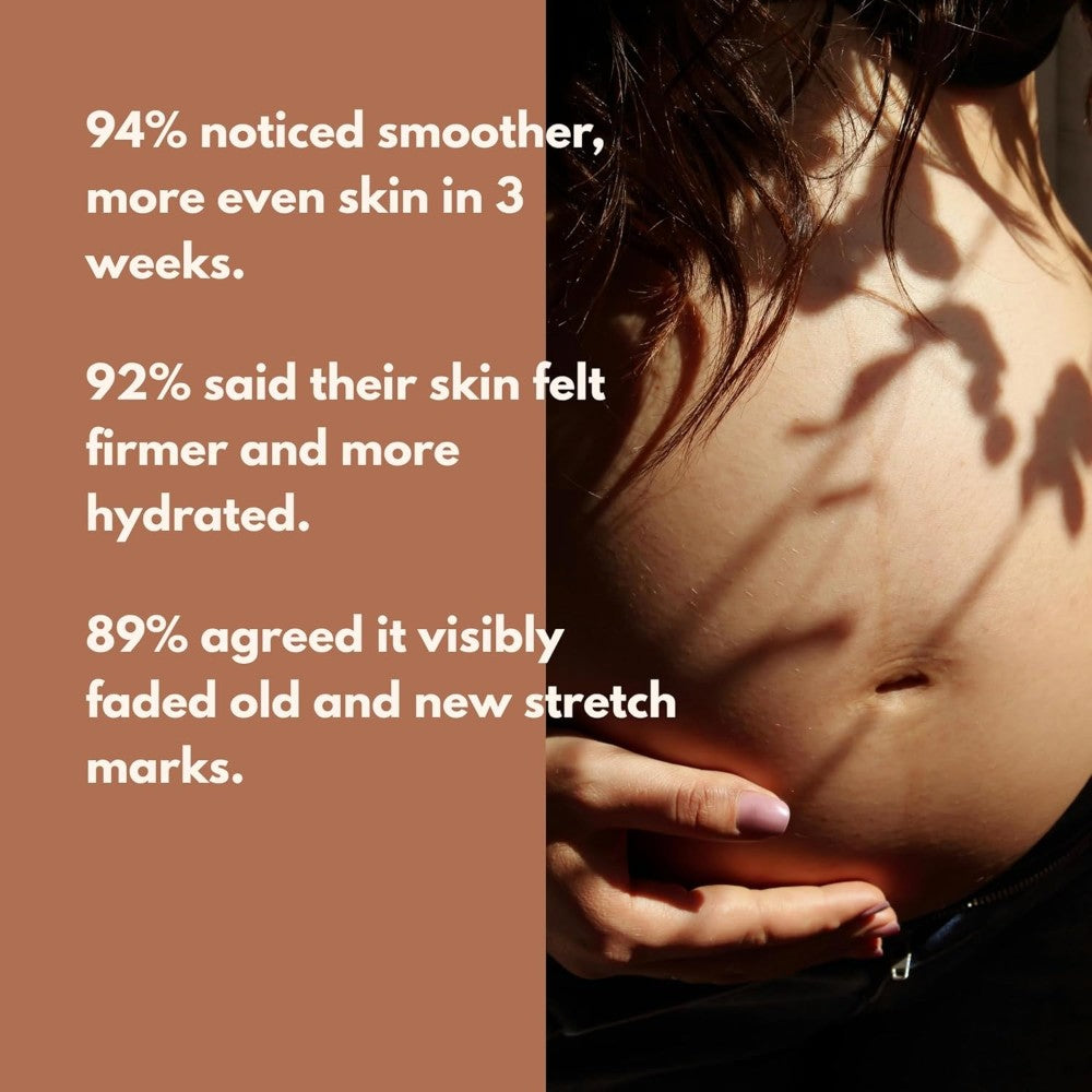 GLO Mama Stretch Mark Oil Roll-On for Pregnancy | With Centella Asiatica & Striover | Prevents & Reduces Stretch Marks | Doctor-Formulated, Safe for Moms-to-Be