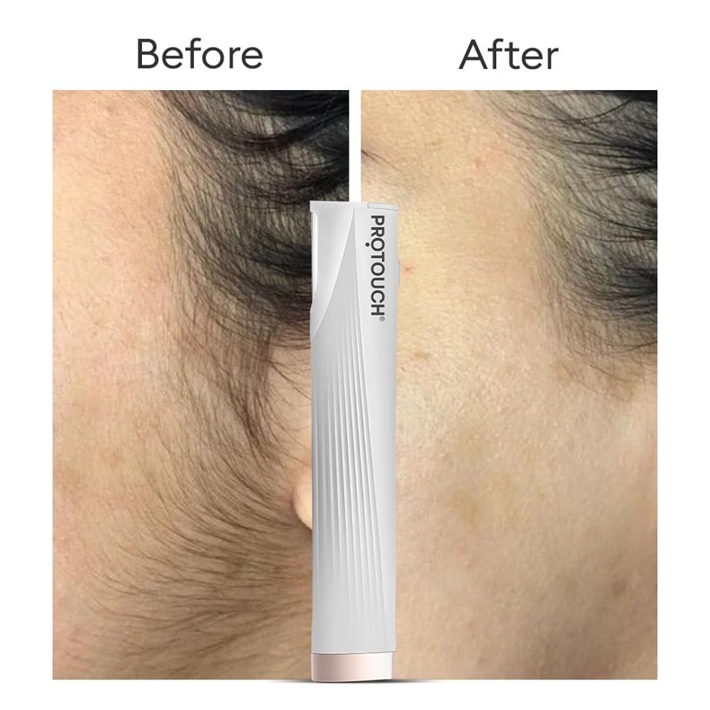 PROTOUCH DERMAPLANING Hair Removal Device - Precision Facial Razor for Women