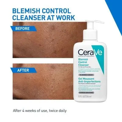 CeraVe Blemish Control Cleanser 236 ml