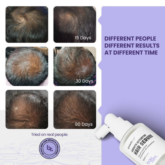 Bayrum Hair Growth Serum | Hair Fall Control & Regrowth | Redensyl 3%, Anagain 3%, Procapil | With Biotin, Caffeine & Rosemary | Men & Women (30 ml)