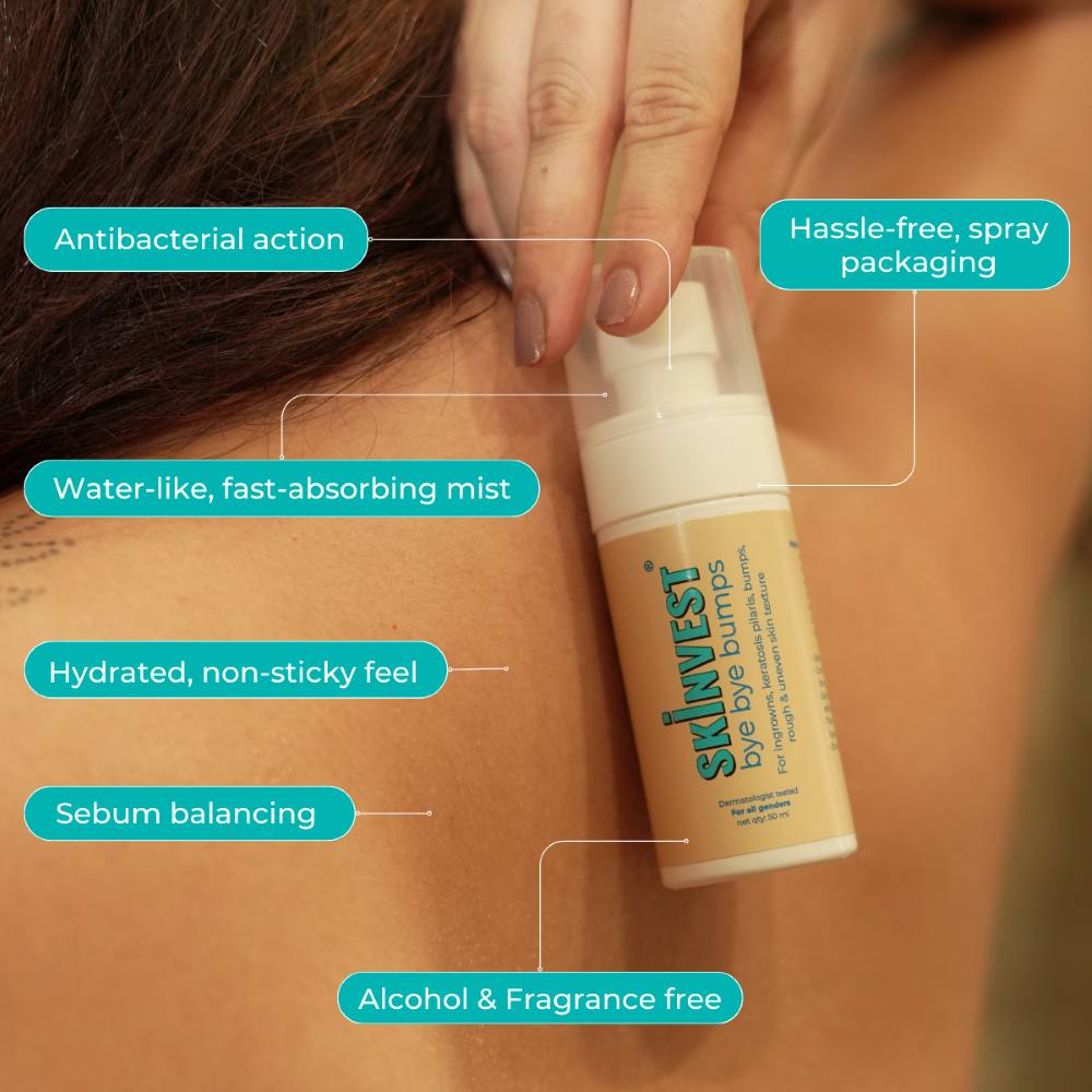 Skinvest Bye Bye Bumps Exfoliating Mist (50ml)