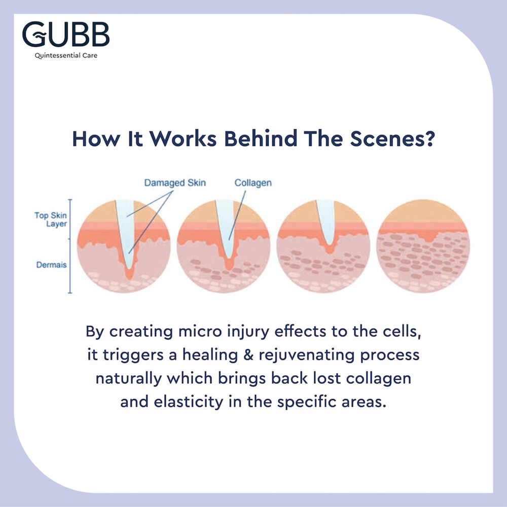 Gubb Derma Roller For Face Acne Scars, Skin Ageing & Hair Regrowth - Reduces Hair Fall - Stimulates Hair Follicles - Suitable for Beard Also - Safe & Effective _ Black