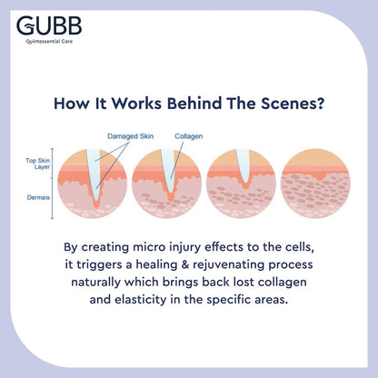 Gubb Derma Roller For Face Acne Scars, Skin Ageing & Hair Regrowth - Reduces Hair Fall - Stimulates Hair Follicles - Suitable for Beard Also - Safe & Effective _ Black