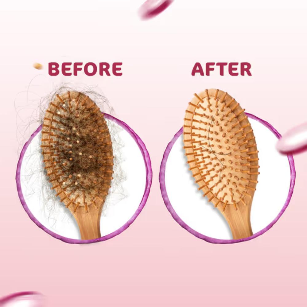Mamaearth Onion Hair Oil With Onion & Redensyl For Hair Fall Control (200ml)