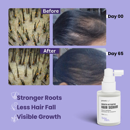 Bayrum Hair Growth Serum | Hair Fall Control & Regrowth | Redensyl 3%, Anagain 3%, Procapil | With Biotin, Caffeine & Rosemary | Men & Women (30 ml)