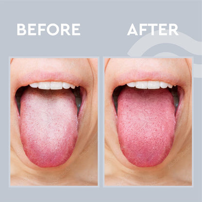 GUBB Tongue Cleaner Loop (Metal)